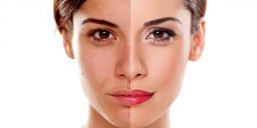 12 måder at ødelægge din hud på