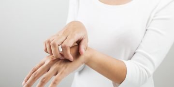 gode råd mod svamp på huden