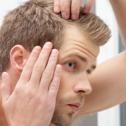 gode råd mod bumser i hovedbunden
