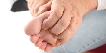 behandling af fodsvamp