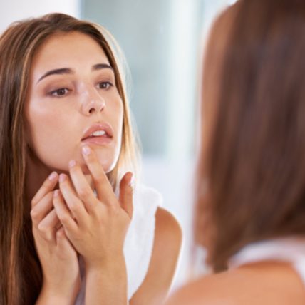 gode råd mod psoriasis